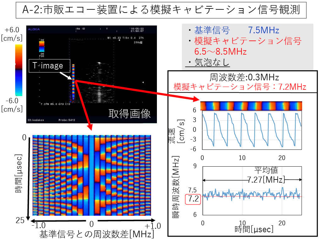 カラードプラ画像を利用したその場観測法02