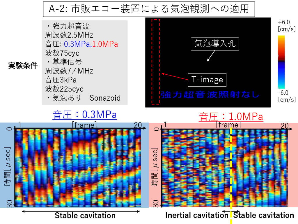 カラードプラ画像を利用したその場観測法03